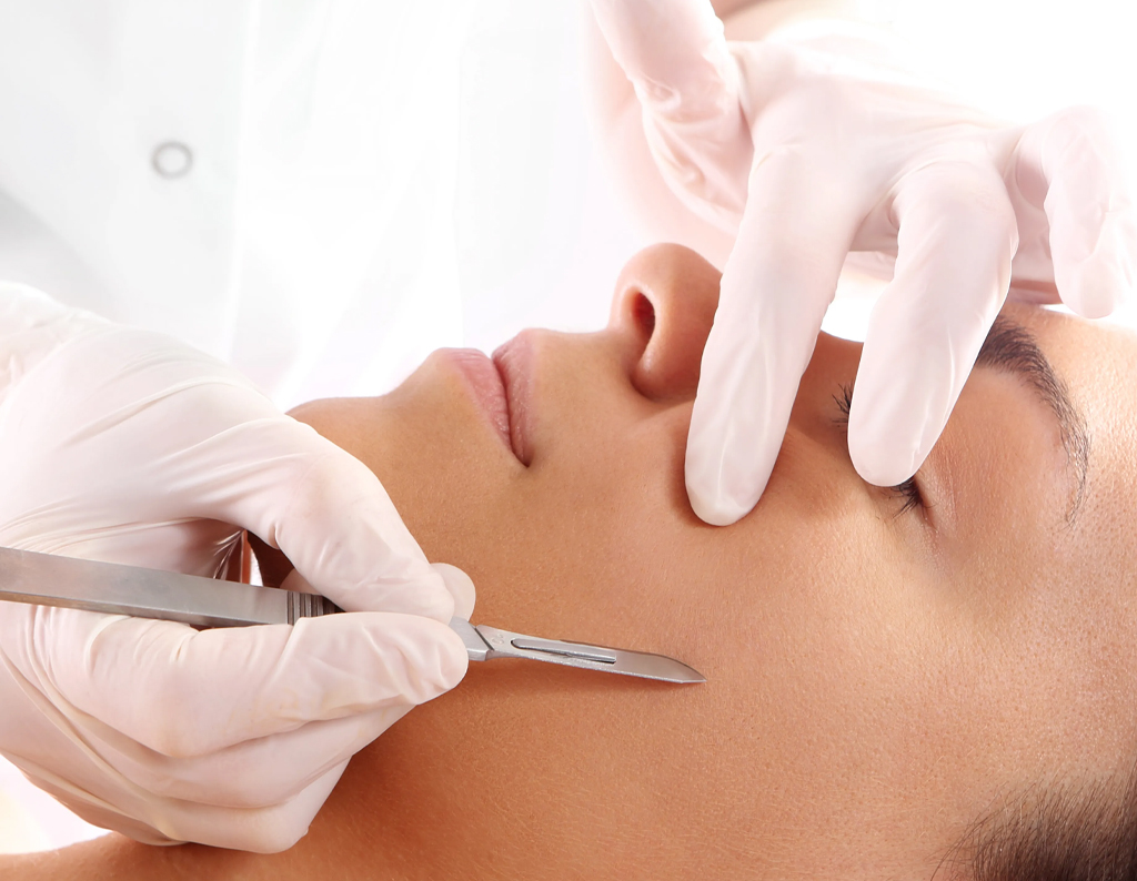 dermaplaning london