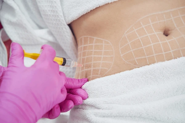 Fat Dissolving Injections in Islington & Angel, London