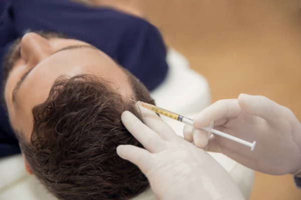 PRP Hair Treatment in Islington & Angel, London
