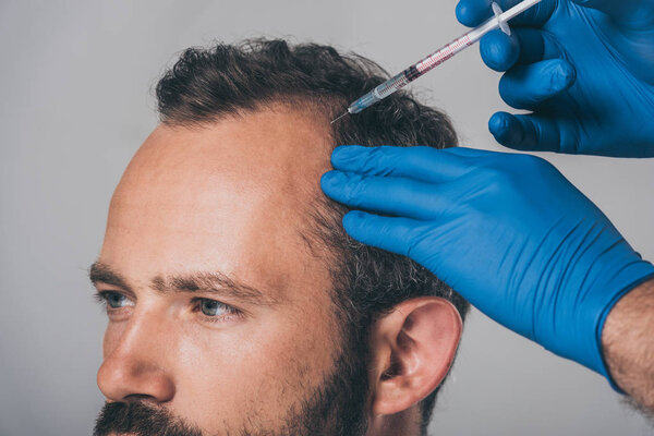 PRP Hair Treatment in Islington & Angel, London