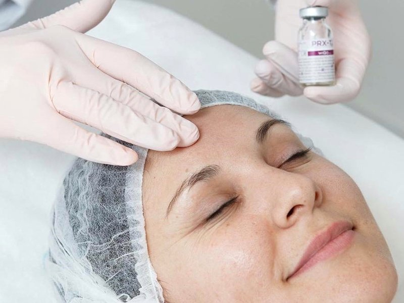 PRX-T Medical Grade Peel in Islington & Angel, London