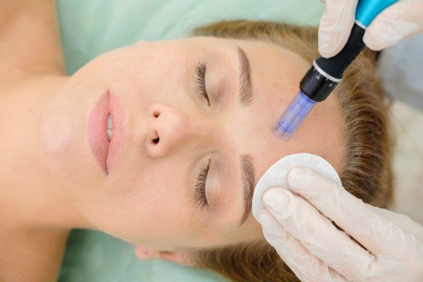 Microneedling vs. PRP
